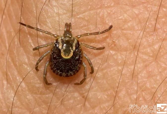 Jundiaí está com sete casos suspeitos de Febre Maculosa