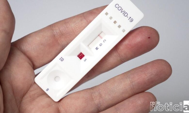 Testes rápidos são aliados na detecção de doenças respiratórias no outono-inverno