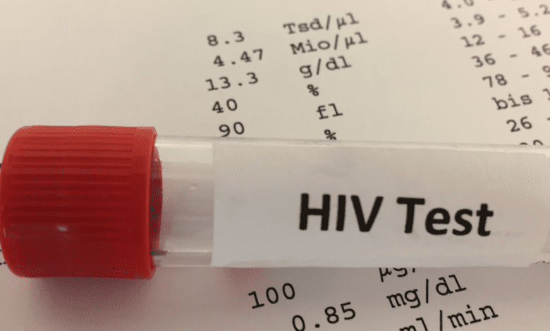 Severínia realiza exames gratuitos de HIV e Sífilis