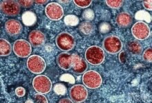 OMS diz que Mpox não é mais emergência sanitária global